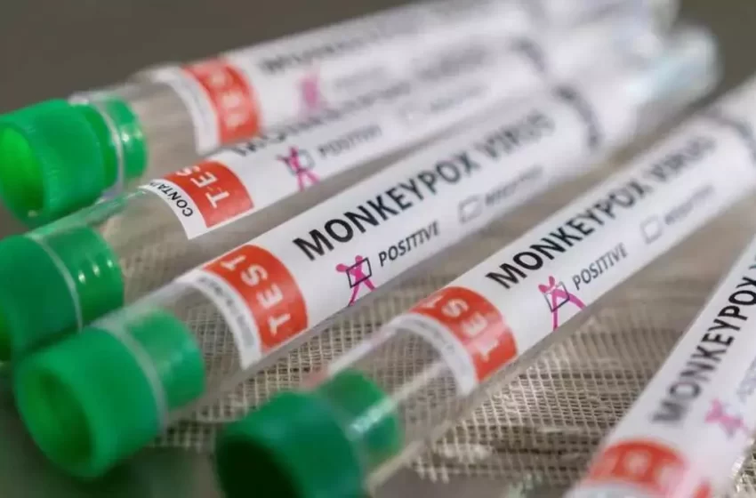 Ministério da Saúde vai instalar centro de operações em resposta à Mpox
