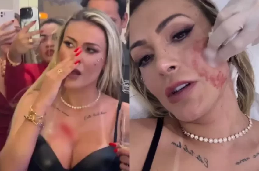  Andressa Urach x Juju Ferrari: briga em festa termina no hospital