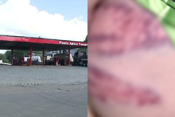  Mulher acusa PM de agressão em posto de gasolina