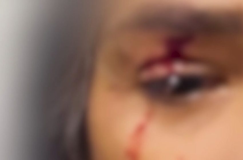  Professora é agredida por aluno após cobrar atividade em colégio cívico-militar